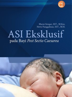 ASI Eksklusif pada Bayi Post Sectio Caesarea